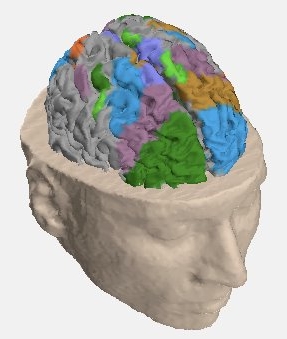 3D reconstruction of brain image