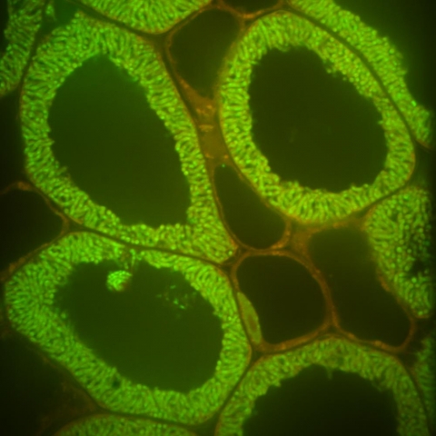Dickstein nodule cells 63x slice.jpg